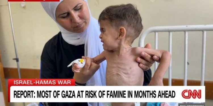 Wounded and sick children leave besieged Gaza Strip, in first medical evacuation for weeks