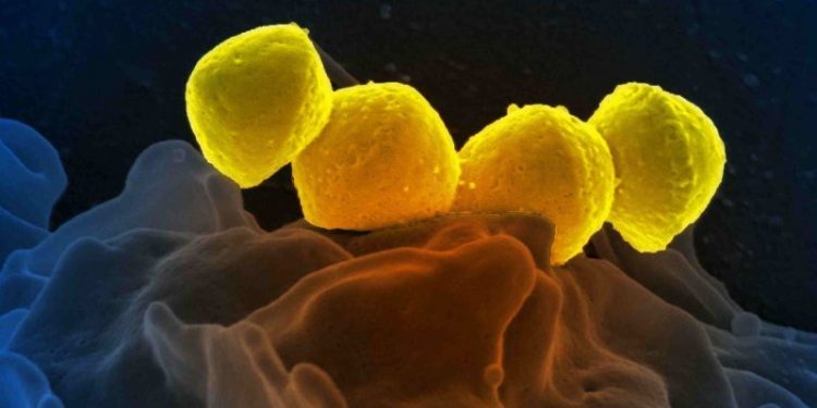 Japan reports record spike in potentially deadly bacterial infection