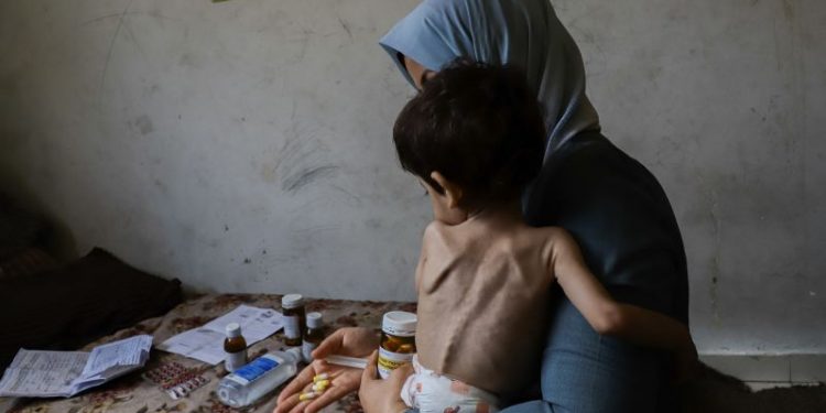 Children are dying of starvation in their parents’ arms as famine spreads through Gaza