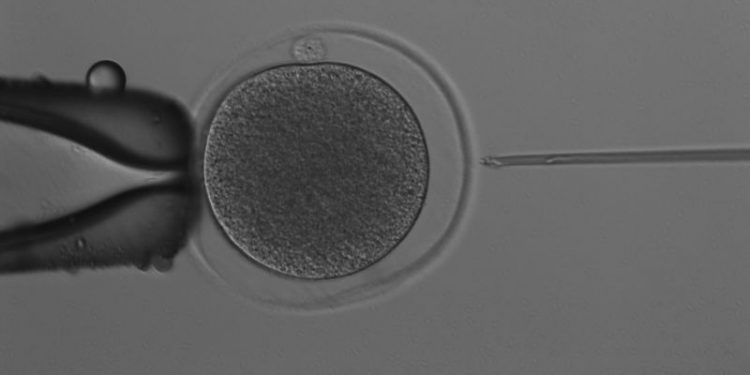 Scientists have produced a kangaroo embryo through IVF. It has sparked hope for marsupial conservation