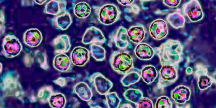 European region sees highest number of measles cases in 25 years, WHO says